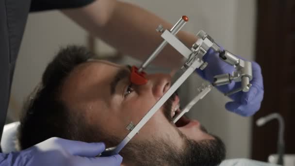 Instalace tvář bow. Moderní technologie. Zubní klinika — Stock video