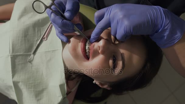 Kieferorthopäde ziehen Gummizug auf Zahnspangen an. gesunde Zähne. gutes Lächeln des Patienten — Stockvideo