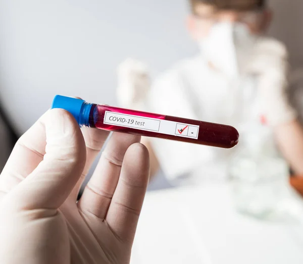 Test Tube Inscription Virus Coronavirus Study Virus Research — Stock Photo, Image