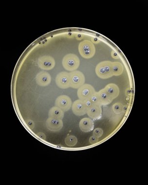 Staphylococcus aureus growing on Baird Parker clipart