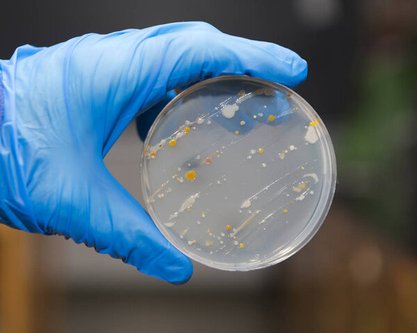 Bacteria on an agar plate