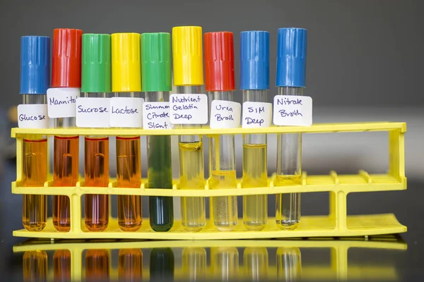 Biochemische Tests Zur Identifizierung Von Mikroorganismen — Stockfoto