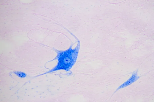 Τεράστιος πολυπολικός νευρώνας — Φωτογραφία Αρχείου