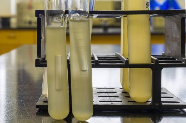 Durham tüpleri bakteriler tarafından gaz üretimini gösteriyor. Bu pozitif bir test sonucu..