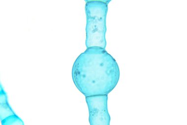 Microscope view of freshwater algae Oedogonium.