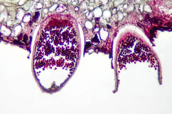 Planta Parasitaria Hongos Puccinia Microscopio Diapositiva —  Fotos de Stock