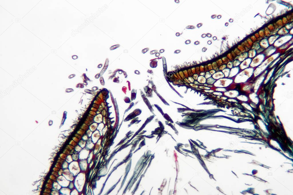 Fucus vesiculosus - female showing conceptacles.