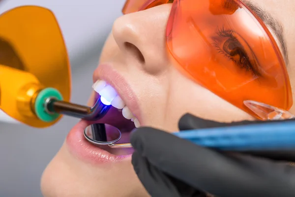 Macro photo of dental treatment — Stock Photo, Image