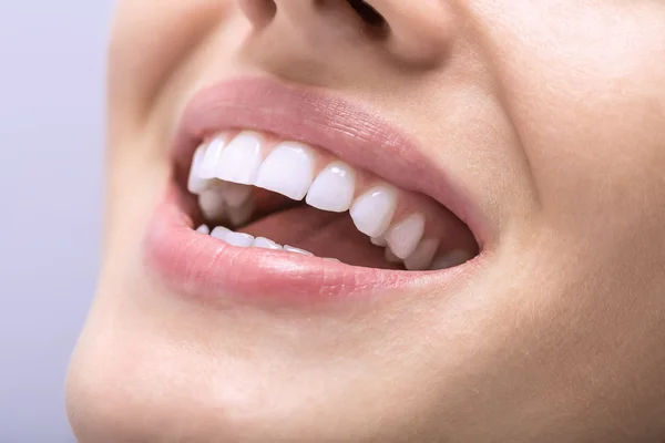 Makro zdjęcie białych zębów — Zdjęcie stockowe