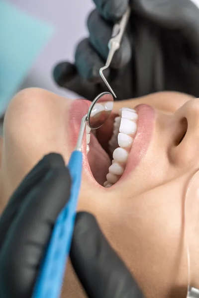 Womans teeth checking — Stockfoto