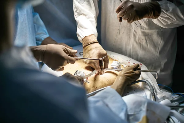 Processo de operação da laparoscopia — Fotografia de Stock