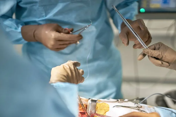 Processo de operação abdominal — Fotografia de Stock