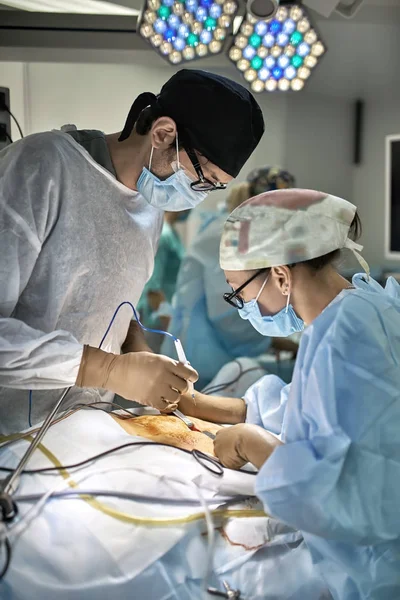 Processo de operação da laparoscopia — Fotografia de Stock
