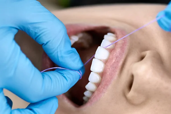 Bella pulizia dei denti delle donne in clinica dentale — Foto Stock