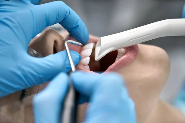 Mulheres bonitas dentes limpeza na clínica odontológica — Fotografia de Stock