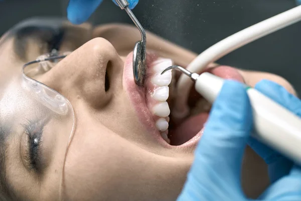 漂亮女人在牙科诊所清洁牙齿 — 图库照片