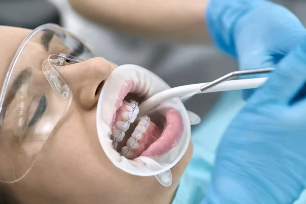 Szép Womans fogak tisztítása a fogászati klinikán — Stock Fotó