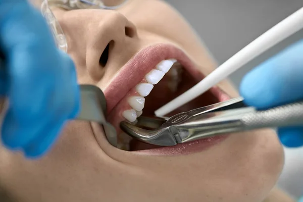 Ładne womans leczenie zębów w klinice stomatologicznej — Zdjęcie stockowe
