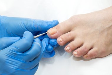 Pedikür süreci