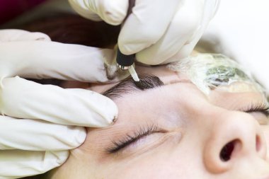 Mikrobleyding kaşlar iş akışı 