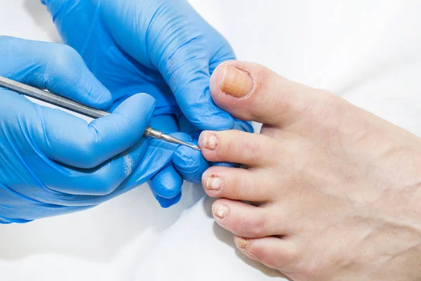 Proces van pedicure — Stockfoto