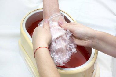 eller işlem parafin tedavisi 