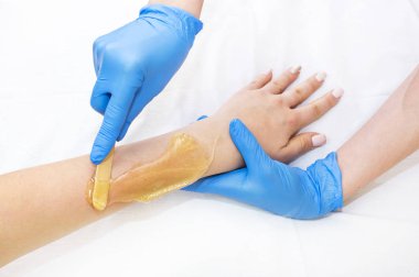 Epilasyon şeker kadın geçer işler 