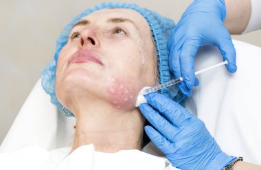 Enjeksiyon ile kozmetik tedavi 