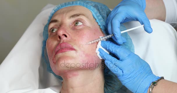 Kosmetisk behandling med injektion — Stockvideo