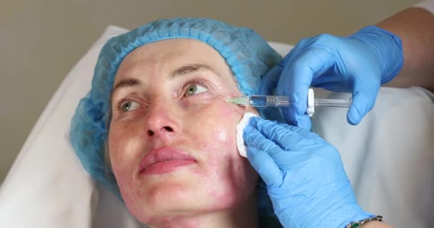 Косметическое лечение с помощью инъекции — стоковое видео