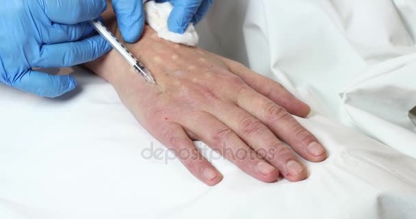 Mesotherapy process på en kvinnlig hand — Stockvideo