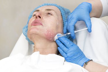 Enjeksiyon ile kozmetik tedavi 