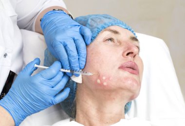 Enjeksiyon ile kozmetik tedavi 