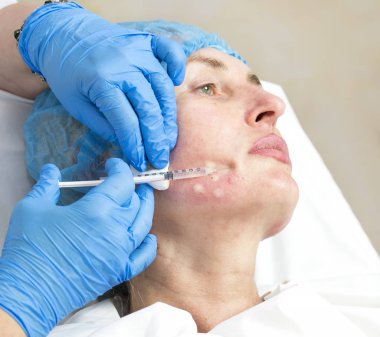 Enjeksiyon ile kozmetik tedavi 