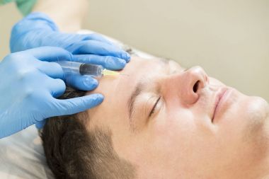 Mezoterapi klinik seyri geçer 