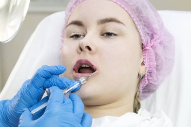 su enjeksiyon alanında bir kadının dudak kozmetik cerrahi