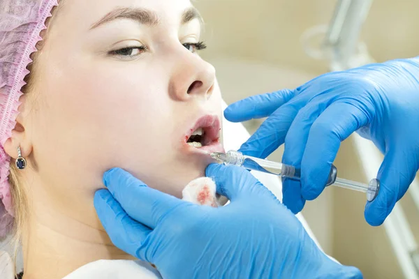 Cosmetische chirurgie van water injectie op het gebied van de lippen van een vrouw — Stockfoto