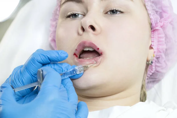 Chirurgie esthétique de l'injection d'eau dans la région des lèvres d'une femme — Photo