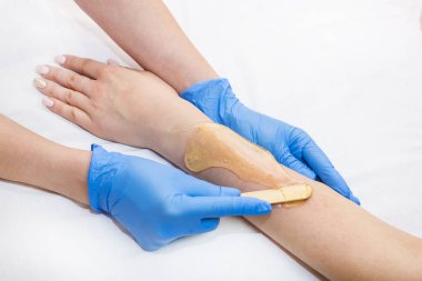 Epilasyon şeker kadın geçer işler 