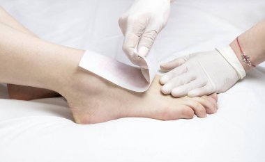 işlem Depilasyon kadın bacakları ve eller