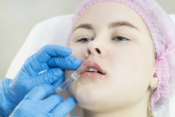 Proceso de cirugía estética de inyección de agua en el área de los labios de una mujer — Foto de Stock