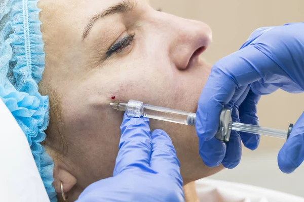 Tratamiento cosmético con inyección —  Fotos de Stock