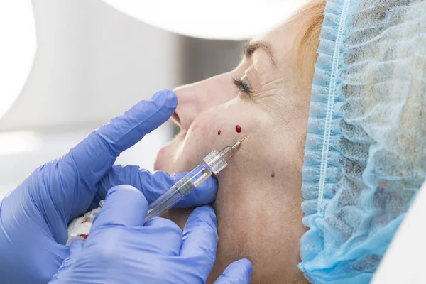 Cosmetic treatment with injection — Stock Photo, Image