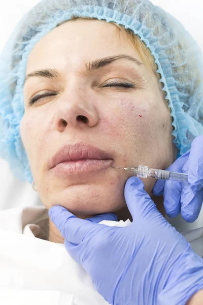 Cosmetic treatment with injection — Stock Photo, Image