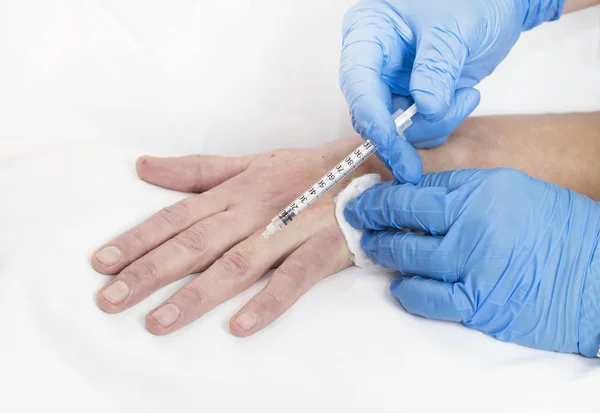 Mesotherapy process on a female hand — Stock Photo, Image