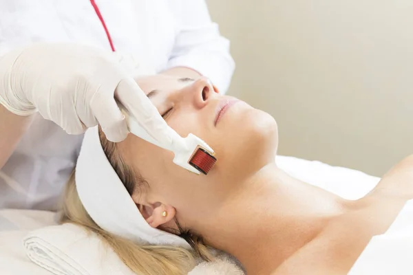 The woman undergoes the procedure of medical micro needle therapy — Stock Photo, Image