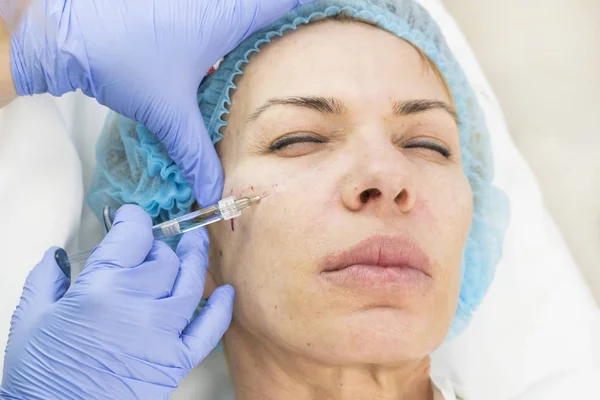 En vuxen kvinna genomgår kosmetisk kirurgi — Stockfoto
