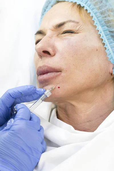 Eine erwachsene Frau unterzieht sich einer Schönheitschirurgie — Stockfoto