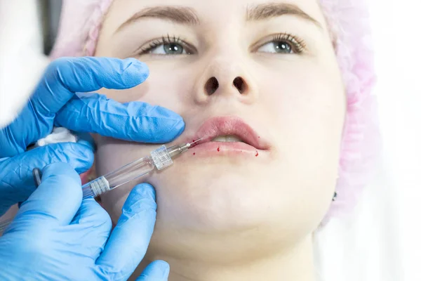 Girl undergoes the procedure of cosmetic surgery to increase the lips — Stock Photo, Image