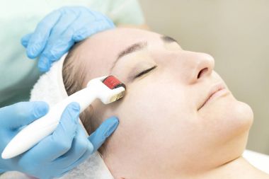 The woman undergoes the procedure of medical micro needle therapy with a modern medical instrument derma roller clipart